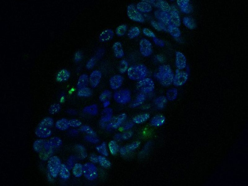 Organoid of a HNC patient, treated with the drug cisplatin. Cell nuclei are visible in blue and DNA damage in green. Credit: Organoid group, copyright Hubrecht Institute.